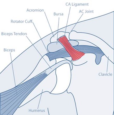 shoulder impingment drawing