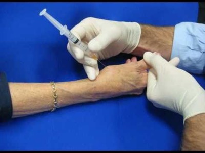 Steroid injections for arthritis in thumb