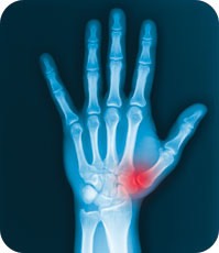 hand-x-ray-web